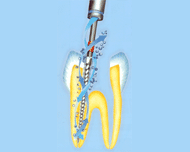 ENAC tips by Dr. Golz