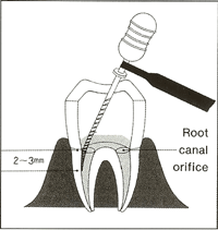 Endex Basic Procedure