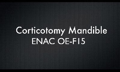 Corticotomy Mandible & Maxilla Procedures