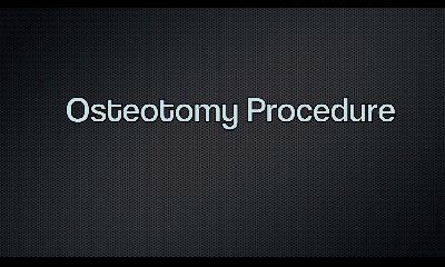 Osteotomy Procedure